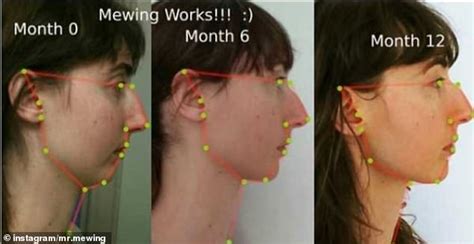 Mewing - no surgery method to reshape your jawline - AR15.COM