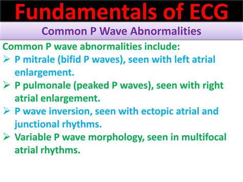 P wave abnormalities in ECG | PPT