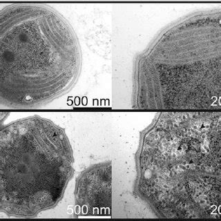 Transmission electron microscopy of the Synechocystis cells ...