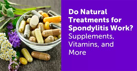 Treating Spondylitis | MySpondylitisTeam