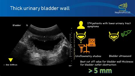 Urinary bladder wall thickness: what is the number to remember ...