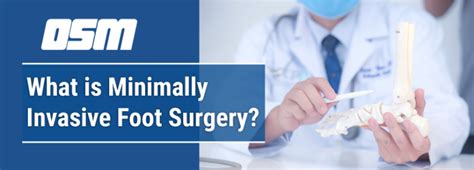 What is Minimally Invasive Foot Surgery? - Orthopedic & Sports Medicine