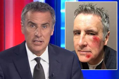 Newsreader Dermot Murnaghan shares picture of his bruised face after revealing he was in a hit ...