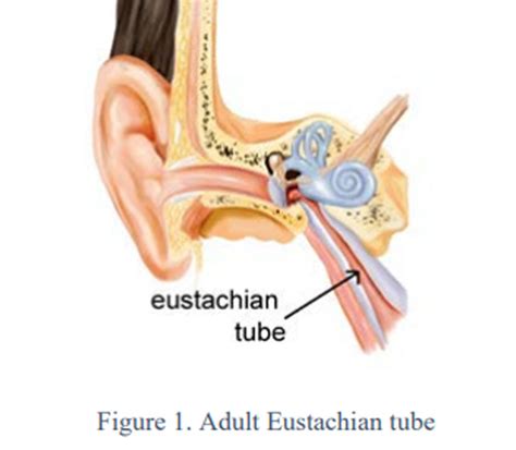 Eustachian Tube Dysfunction Treatment in Thousand Oaks