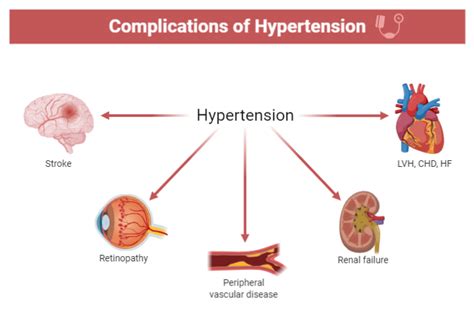 Complications of Hypertension | BioRender Science Templates