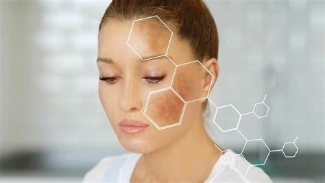 Which laser to do for melasma treatment? - Sparsh Skin Clinic