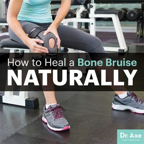 How to Heal a Bone Bruise Naturally - Dr. Axe