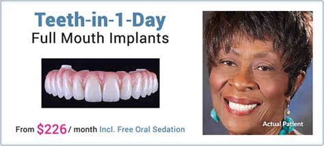 Dental implants in one day? - Dental News Network