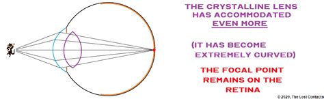 The Optics of Vision - Part 9: The Crystalline Lens - The Lost Contacts