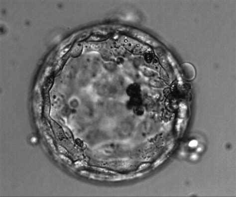 B. Inner cell mass morphology - Eshre