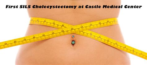 Dr. Fowler Performs First SILS Cholecystectomy at Castle Medical Center | Aloha Surgery | Weight ...