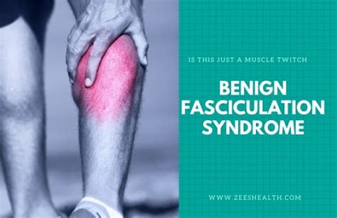 Benign fasciculation syndrome: Causes, symptoms, and treatment ~ Zeeshealth for all: Gloom with ...