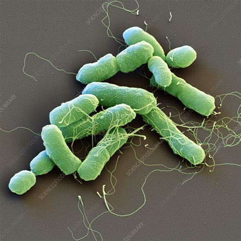 Proteus mirabilis bacteria, SEM - Stock Image - C049/1714 - Science ...