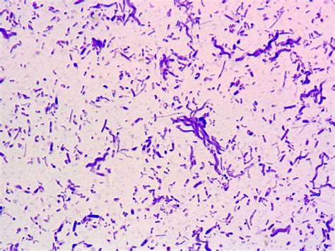 BS001 - Bacteria Smear, 3 Types - Valley Microscope