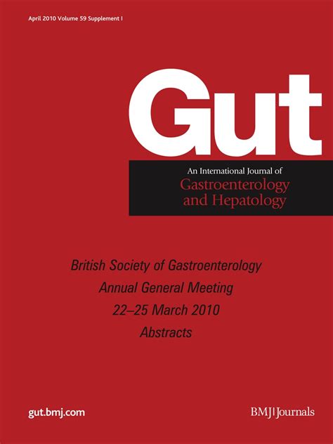 PTH-054 Head to head comparative audit of peg vs rig: a single centre experience | Gut