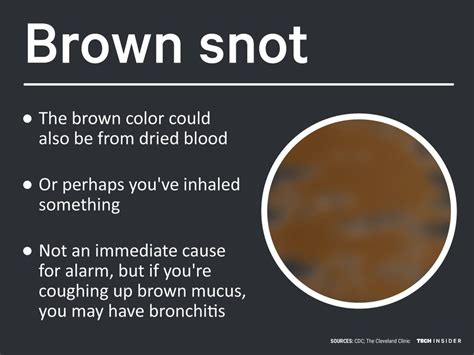 Coughing Up Brown Mucus Causes Remedies - vrogue.co