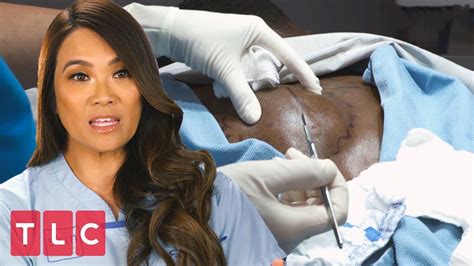 A Dangerous Lump Near the Spine | Dr. Pimple Popper - YouTube