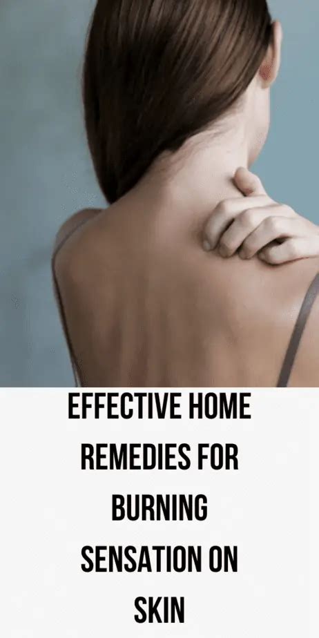 Effective Home Remedies For Burning Sensation On Skin - Type and Seek ...