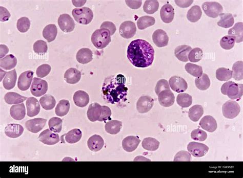 Plasmodium falciparum microscope hi-res stock photography and images - Alamy