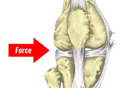 MCL Sprain - Symptoms, Treatment, Exercises & Rehabilitation (2022)