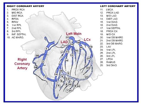 3. Alderman EL, Stadius ML. The angiographic definitions of the Bypass Angioplasty ...