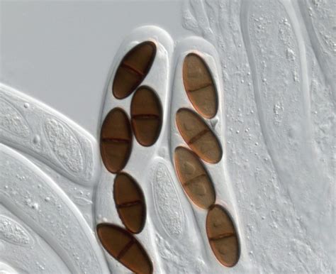 Identification Of Ascomycetes: The Sac Fungi : Plantlet