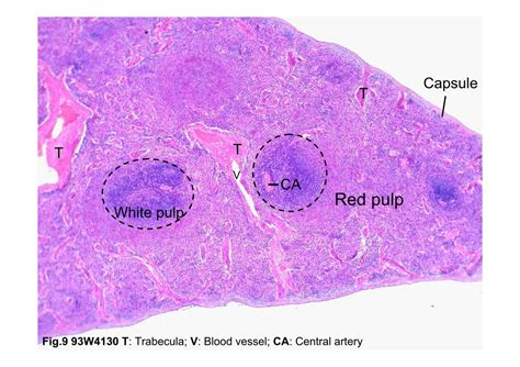 Block2/Fig.9 93W4130 Spleen, H&E.