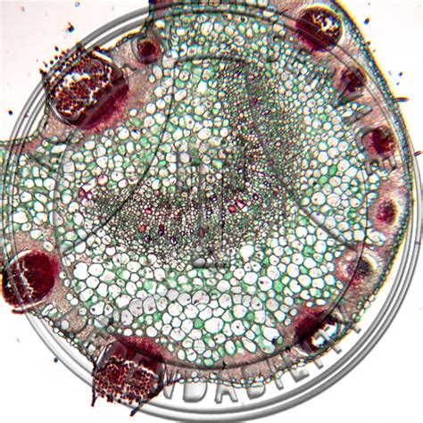 Puccinia coronata Aecia & Spermogonia Rhamnus Leaf Microscope Slide