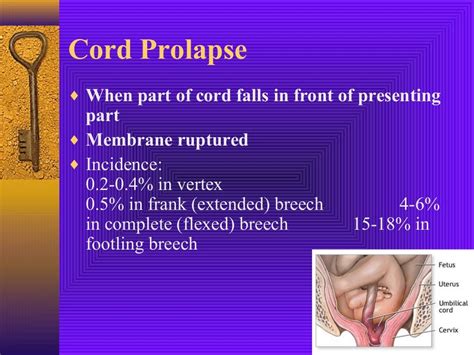 Cord Prolapse