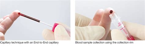 Tip of the month: Capillary blood collection - Sarstedt