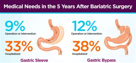 Study shows lower long-term complications with Gastric Sleeve Surgery