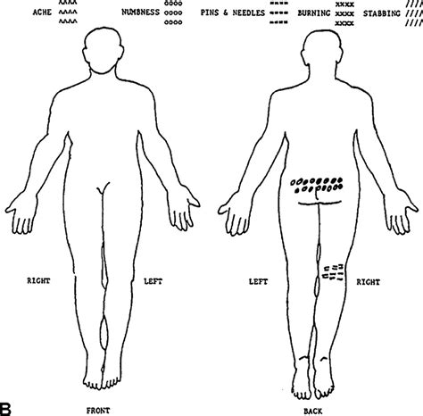 A completed pain drawing.(Adopted from [16]) | Download Scientific Diagram