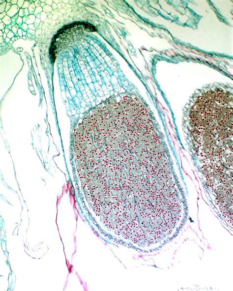 ‎Longitudinal section of attached sporophyte of Marchantia - UWDC - UW-Madison Libraries