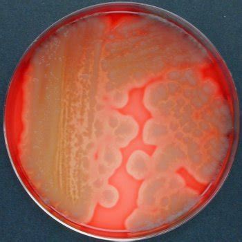 Bacillus thuringiensis