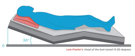 Fowler’s position, uses for Fowler’s position