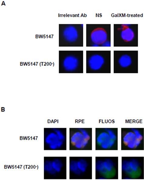 Figure 3 from Role of CD45 Signaling Pathway in Galactoxylomannan ...