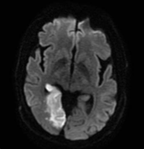 the xray doctor: xrayoftheweek 38: a classic brain MRI finding