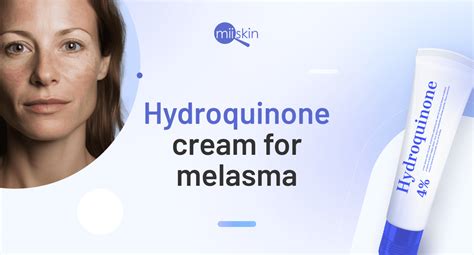 How to get hydroquinone cream for melasma?