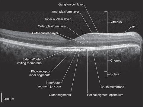 Optical coherence tomography - American Academy of Ophthalmology