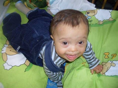 Judge Halts Ohio Ban on Aborting Down Syndrome Babies, Says They're Not ...