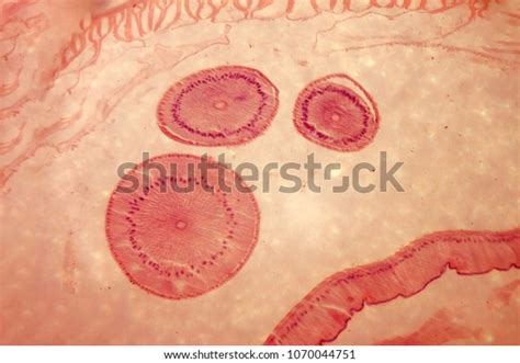 Human Worm Under Microscope Stock Photo 1070044751 | Shutterstock