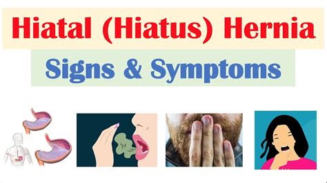 Hiatal (Hiatus) Hernia Signs & Symptoms (& Why They Occur) - YouTube