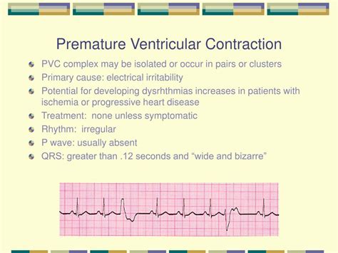 Premature Ventricular Contractions Pvcs Example Images And Photos | My ...