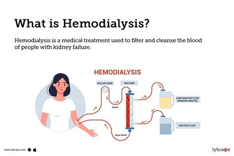 Hemodialysis: Causes, Symptoms, Treatment and Cost