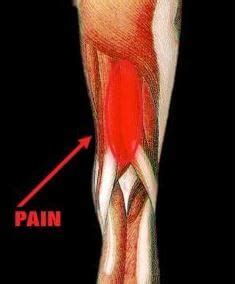 Hamstring Strain or Tear - Pro-Tec Athletics