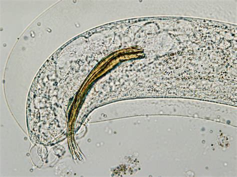 Lungworm In Cats (Vet Answer): Signs, Causes, Care & FAQ - Catster