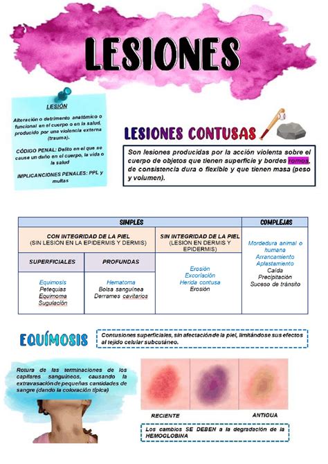 Equimosis Y Hematoma