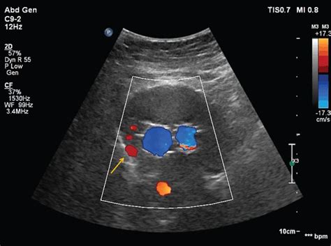 Comparison of portable ultrasound system and high end ultrasound system ...