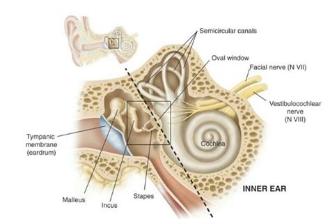 Stapedectomy Treatment