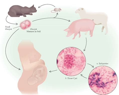 Toxoplasmosis in pregnancy: symptoms and causes of the disease